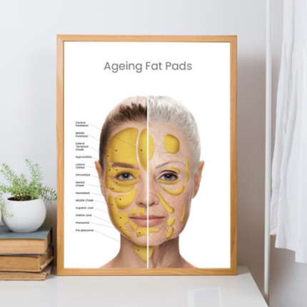 buy aging fat pad poster online